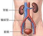 膀胱炎症状图