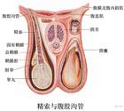 附睾炎图片